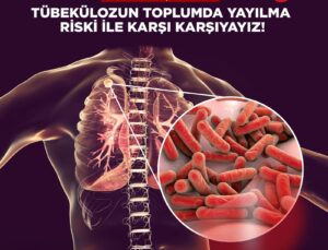 Kıbrıs Türk Tabipleri Birliği: “Verem taramasında PPD testi şart”